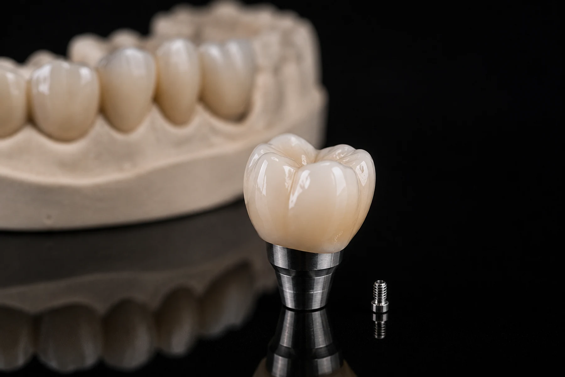 Coroa protética sobre implante dentário, ao lado do parafuso de fixação
